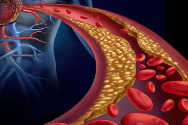 கொலஸ்ட்ரால்