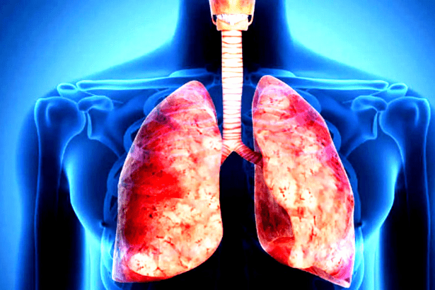 ஆஸ்துமா