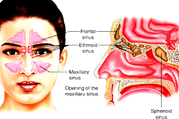 மூக்கில் இரத்தம்