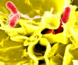 நச்சுணவு -காரணமும், தடுப்பு முறைகளும்! மருத்துவம்