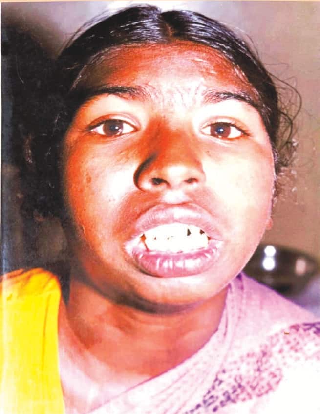 “ஆத்தா மூடிய வாயை திறந்து வைத்த அறிவியல்”-1 கட்டுரை, ஞாயிறு மலர்